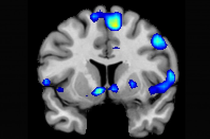 실험참가자의 기능성 자기공명영상(fMRI) 이미지. 신앙적 체험을 하면 뇌의 보상회로를 비롯한 여러 부위가 활성화된다. - 유타대 제공